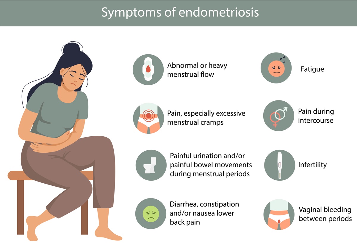 Endometrióza - příznaky.